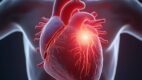 Aortopulmonary Septal Defect