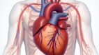 Inferior Myocardial Infarction (Heart Attack)
