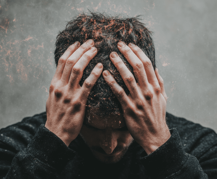 Posterior Reversible Encephalopathy Syndrome