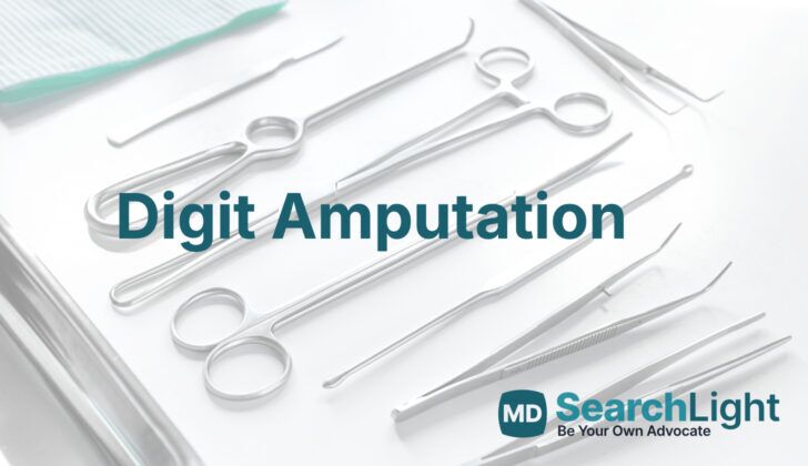 Digit Amputation