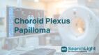 Choroid Plexus Papilloma