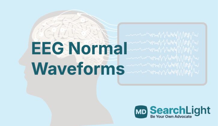EEG Normal Waveforms