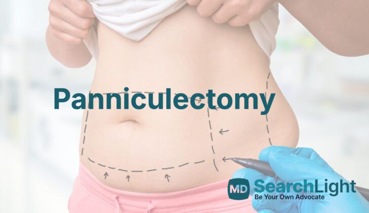 Panniculectomy