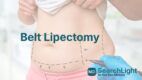 Belt Lipectomy